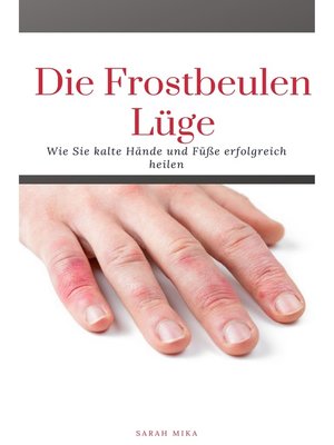 cover image of Die Frostbeulen Lüge